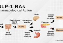Where Metformin and GLP-1s Intersect
